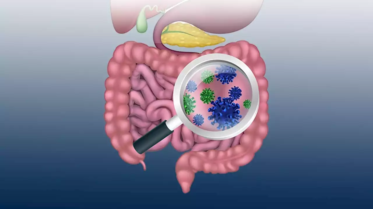 COVID Raises Risk for Long-Term GI Complications