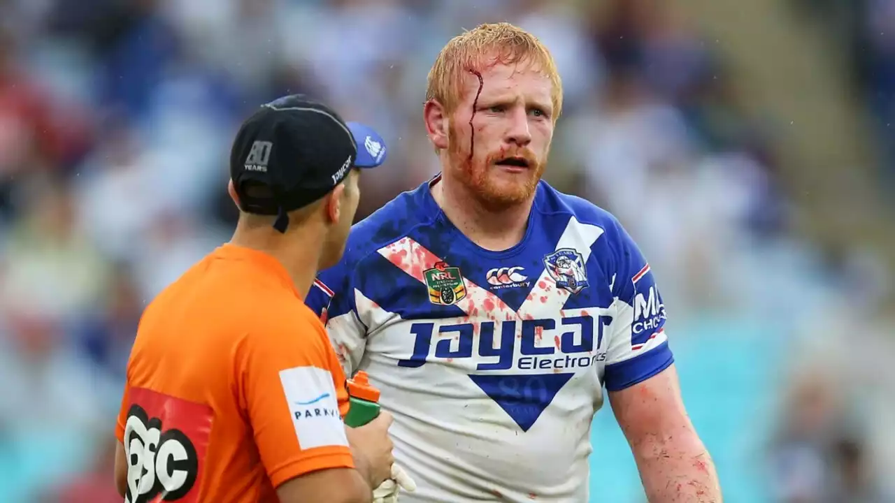 NRL concussion stand-down rule a ‘step in the right direction’ but ‘more needs to be done&#8217;