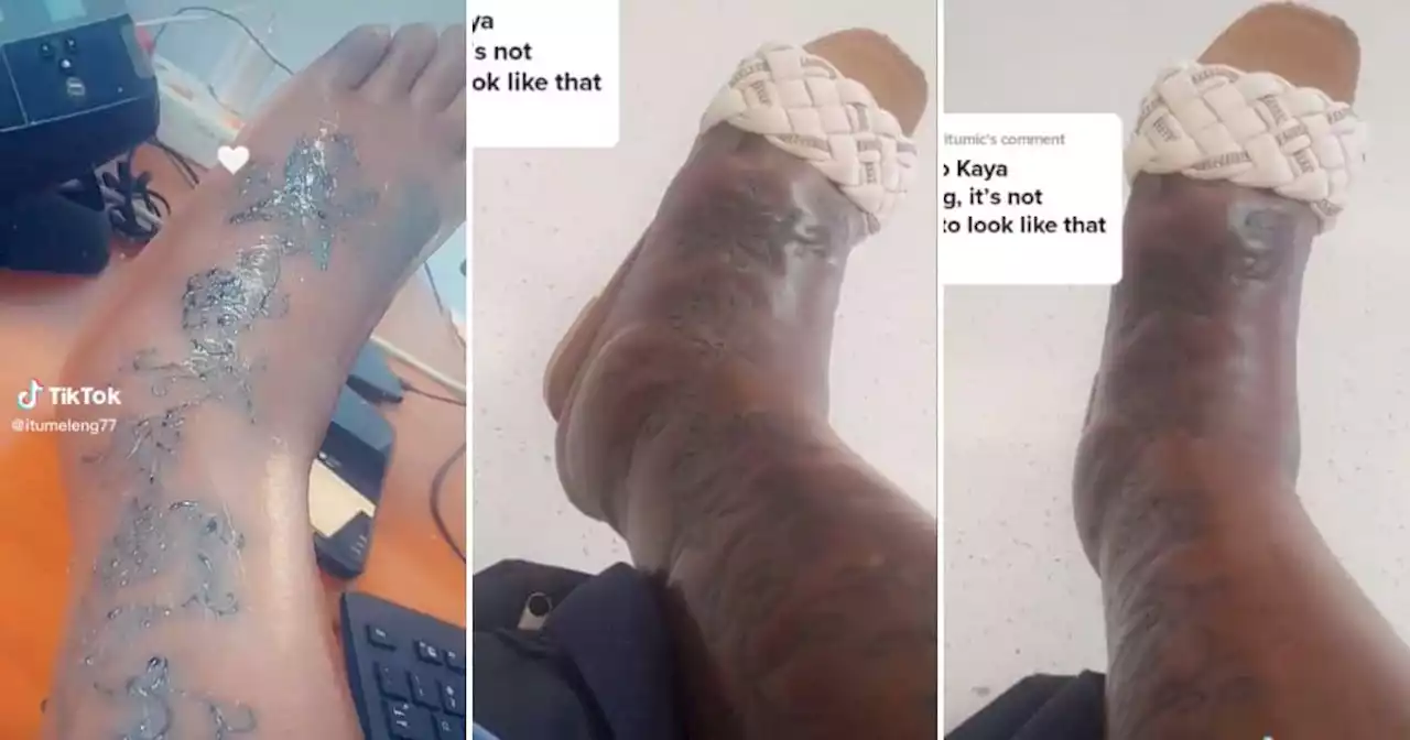 'Amputation is next': Lady shares disturbing videos of leg infected from tattoo