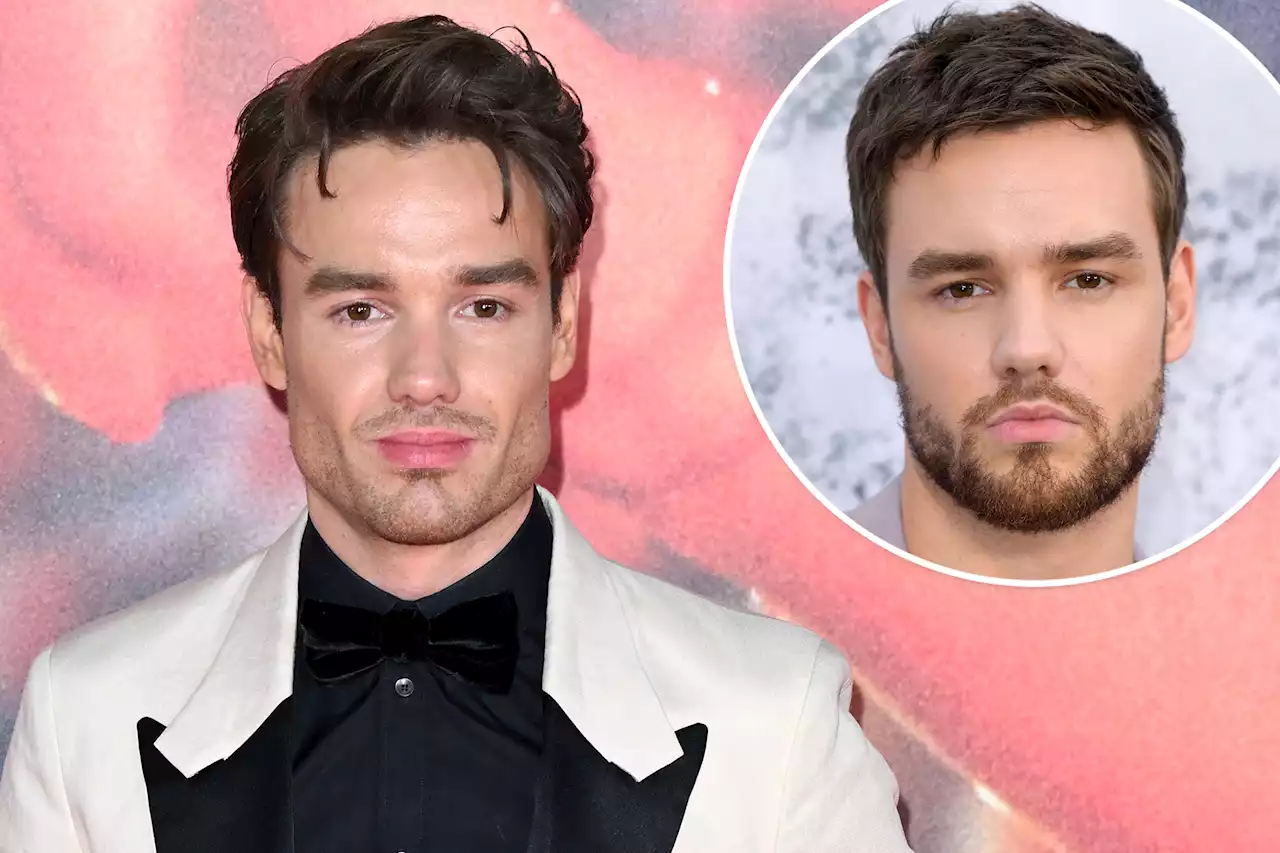 Cosmetic surgery experts weigh in on Liam Payne’s shocking new look