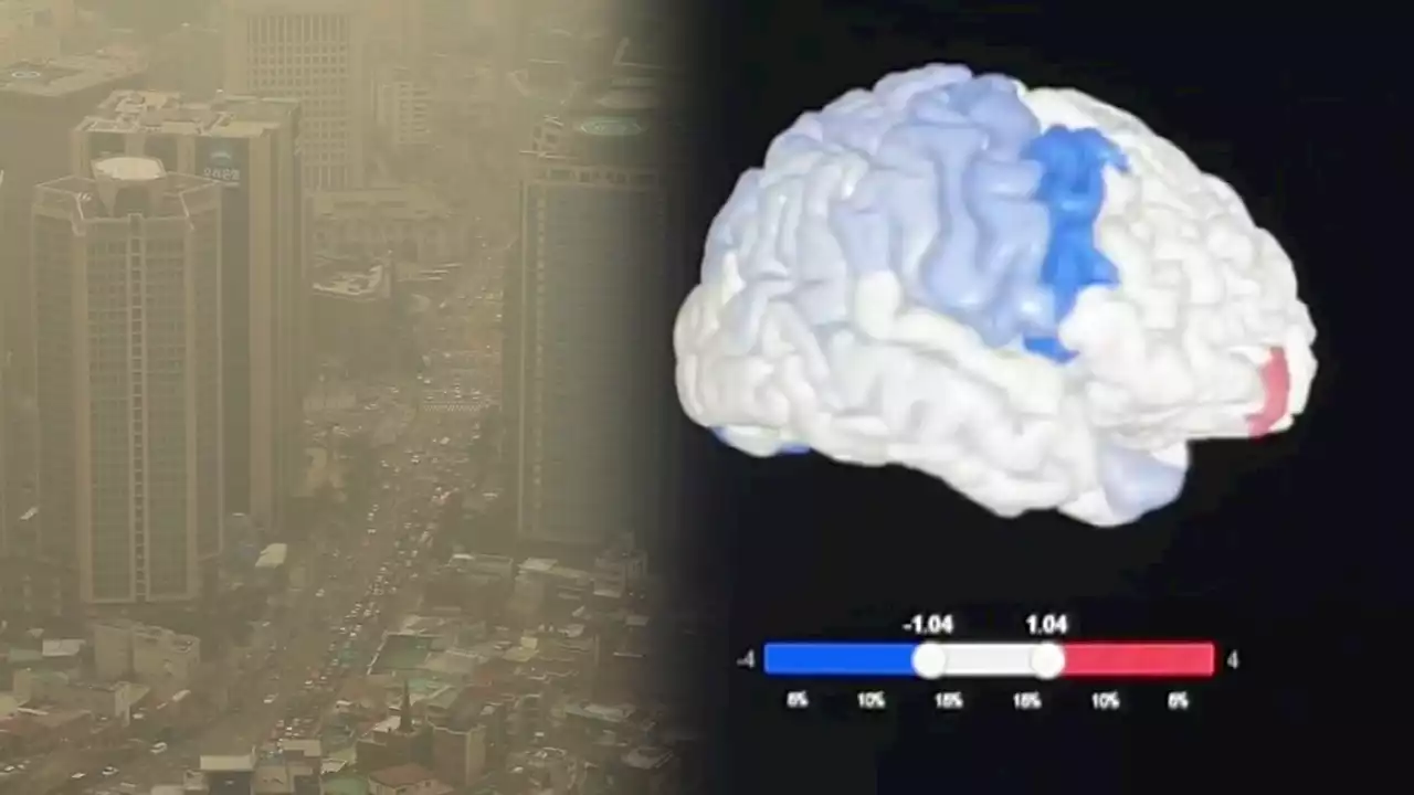 대기오염 심하면 마스크 필수...'치매 위험 높아진다'