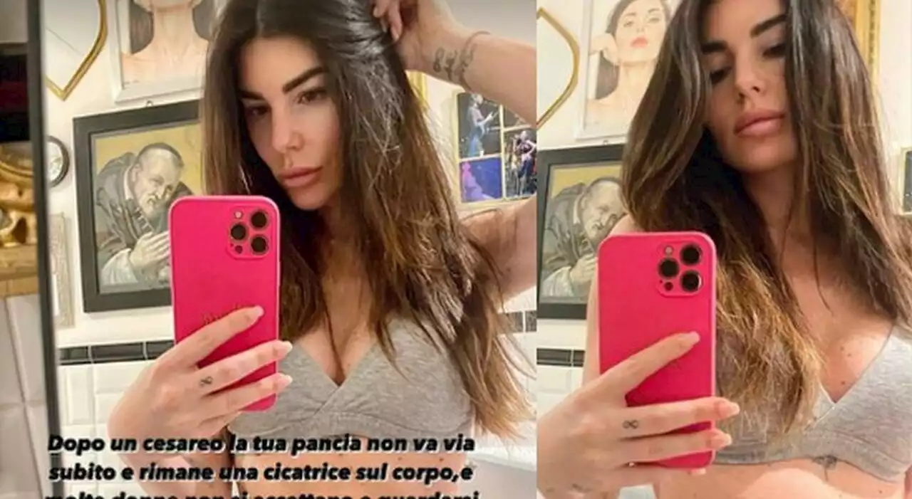 Bianca Atzei, le cicatrici del cesareo dopo il parto: pioggia di offese, cosa è successo