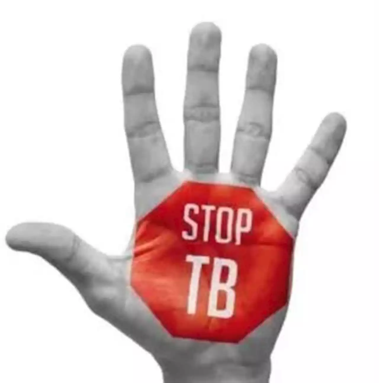 Scientists have discovered that TB is also found in animals | City Press