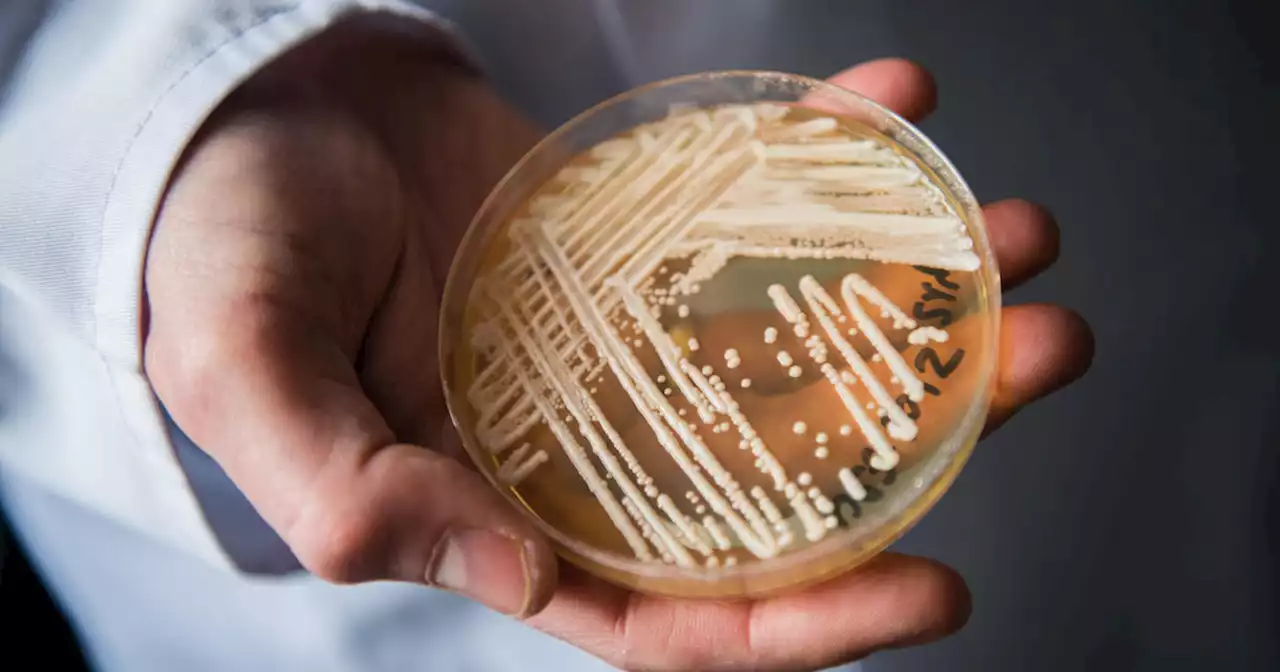 CDC warns of 'alarming' rise of drug-resistant fungus Candida auris causing deadly outbreaks in hospitals