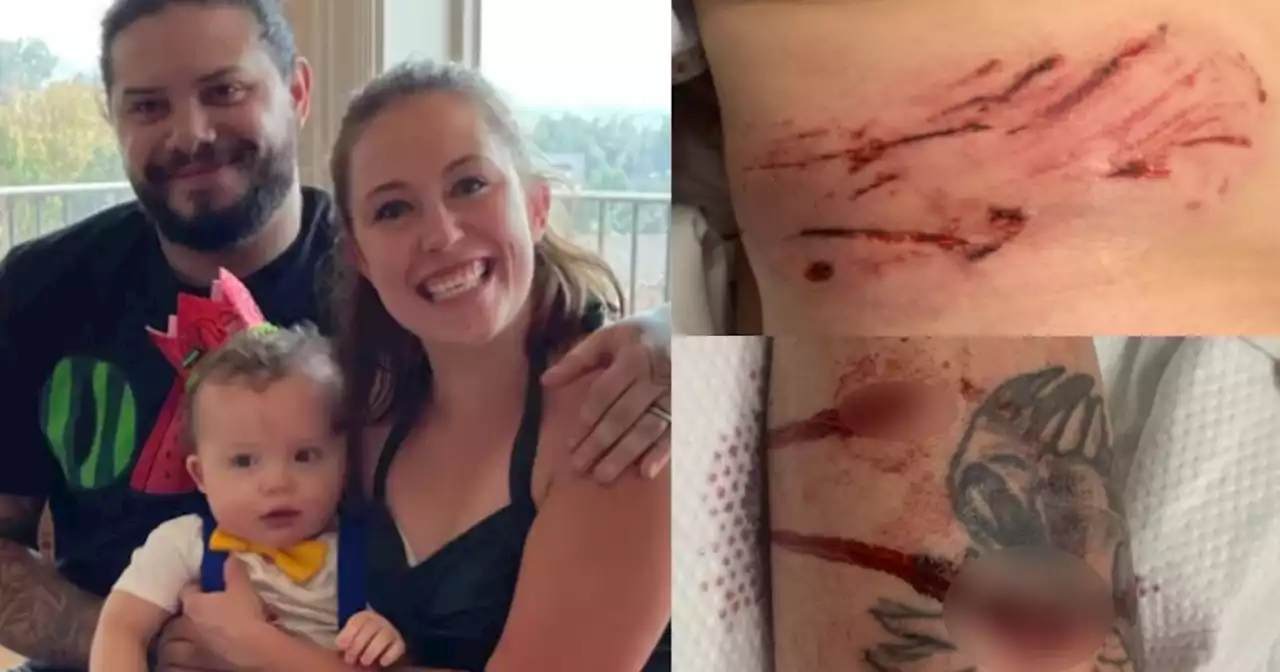 Woman saved by bus driver during brutal dog attack in Salt Lake County