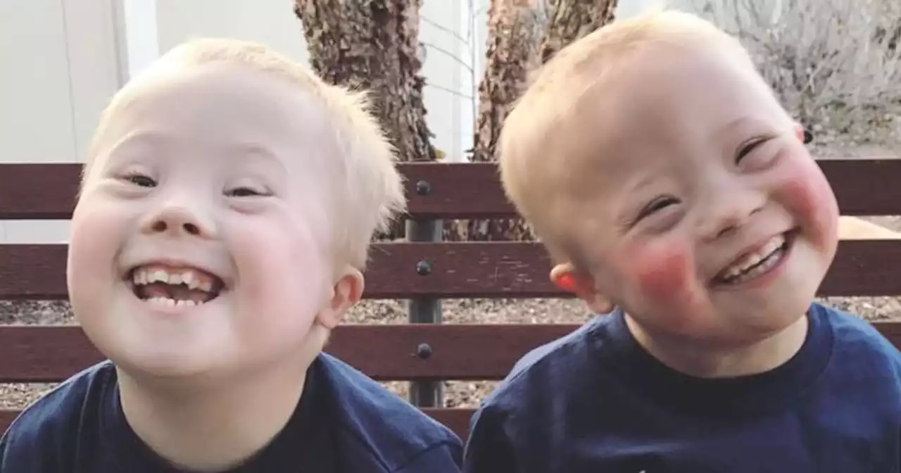 Everything you need to know about Down syndrome