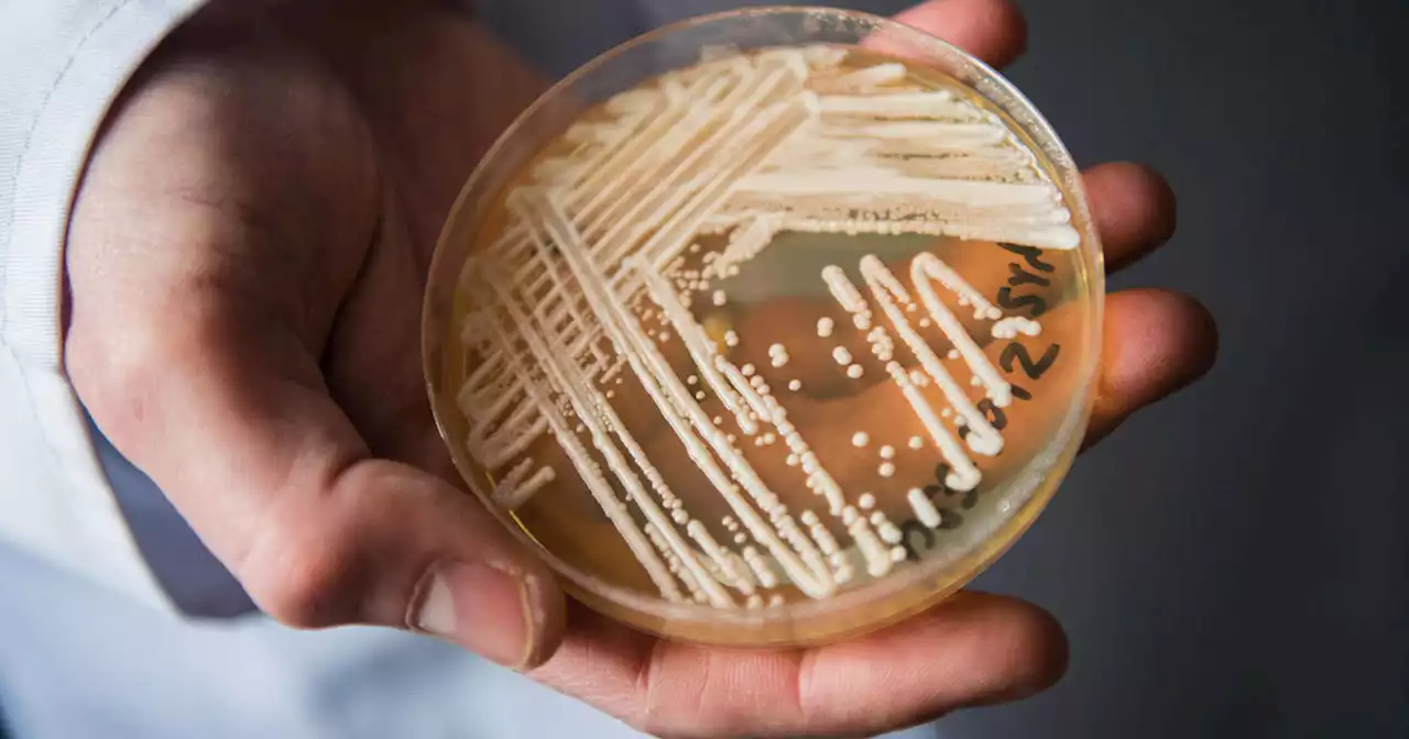 Chicago medical expert sounds alarm over drug-resistant Candida auris fungal infections