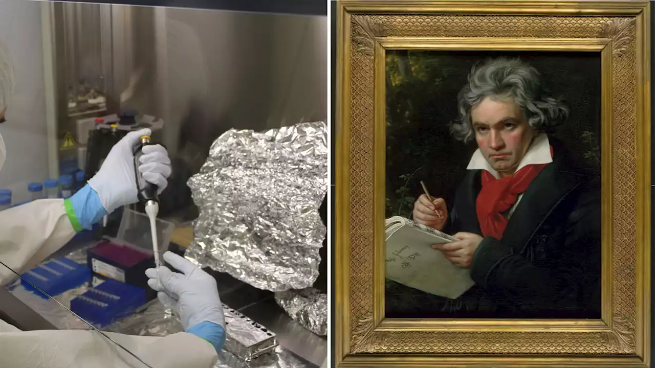 Beethoven's death: Whole-genome sequencing from hair reveals Hepatitis B