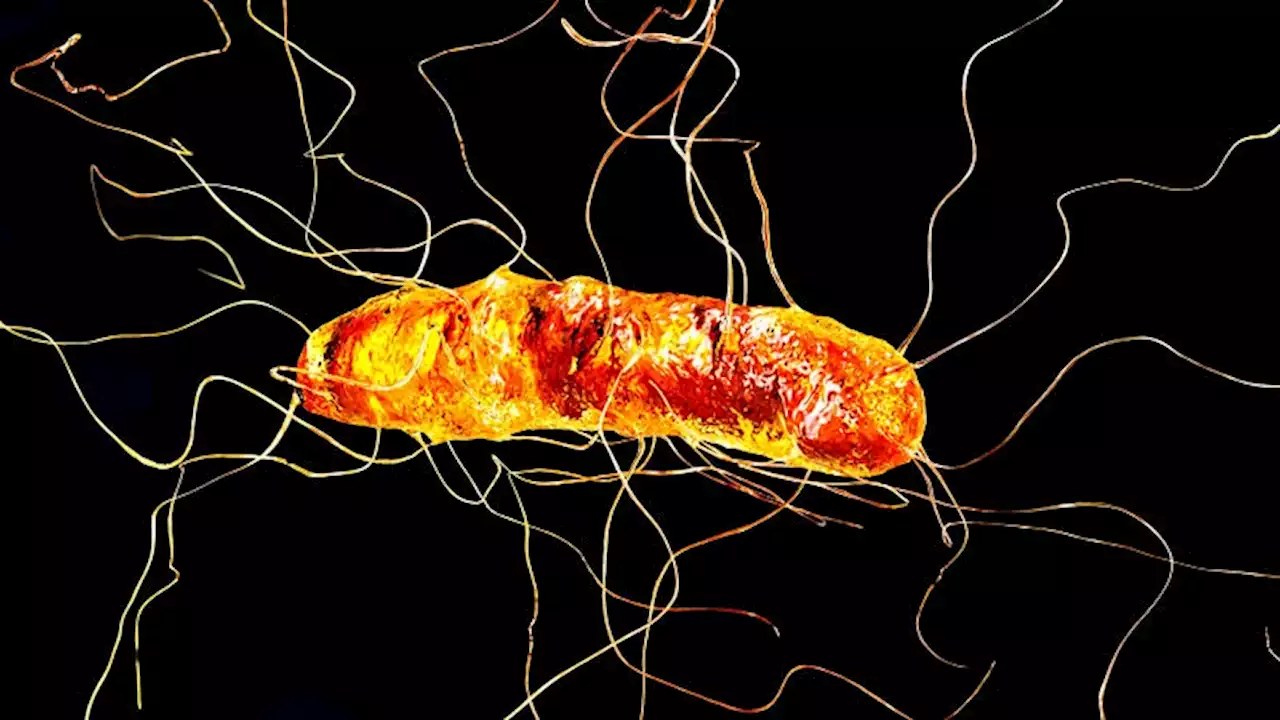 Possible C. difficile–Colon Cancer Connection: Study