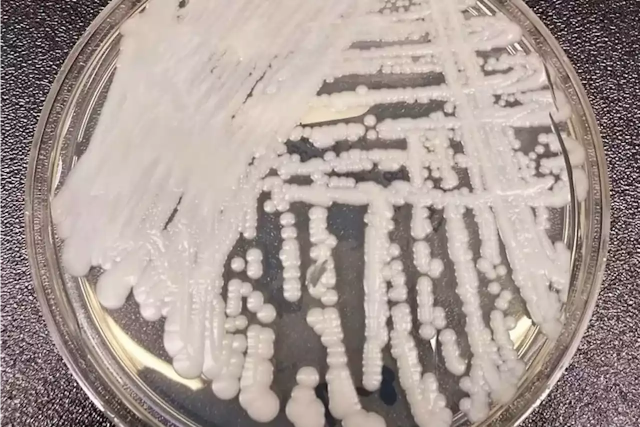 Superbug fungus cases rose dramatically during pandemic