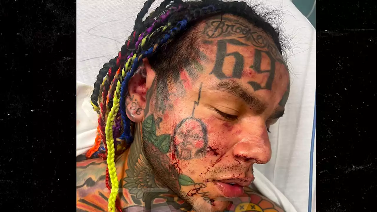 Tekashi 6ix9ine Severely Beaten in Ambush Attack in Gym Sauna, Rushed to Hospital