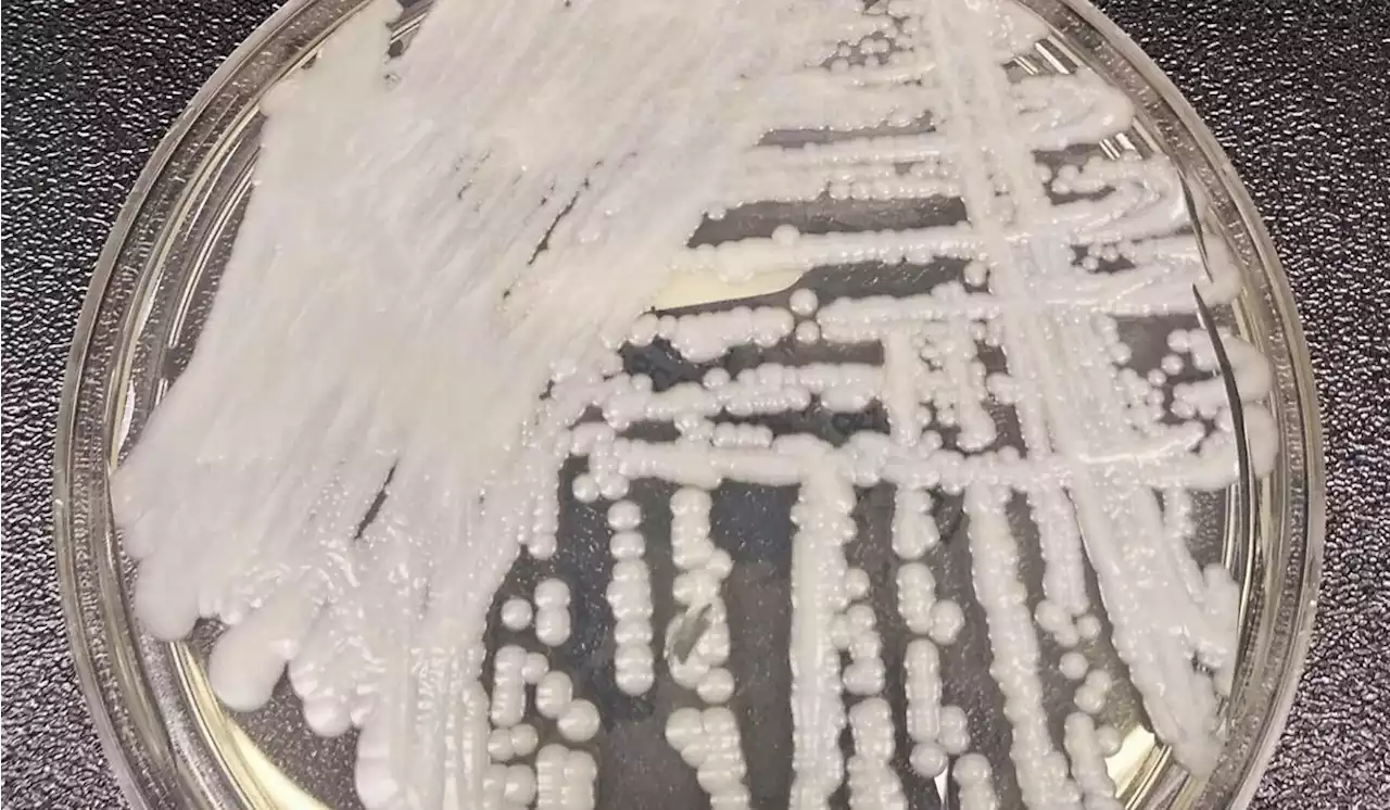 Superbug fungus cases rose dramatically during pandemic