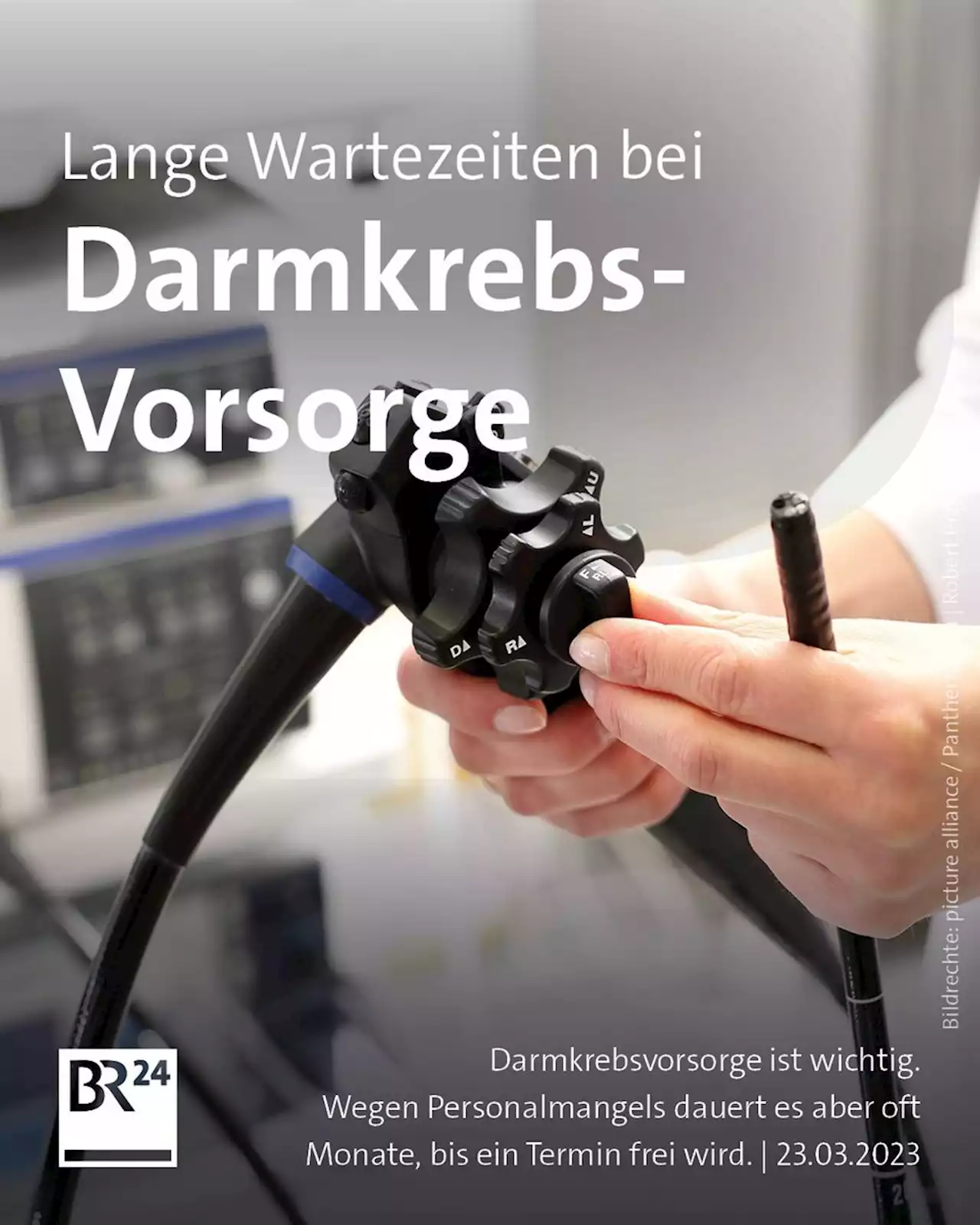 Personalmangel: Lange Wartezeiten bei Darmkrebs-Vorsorge