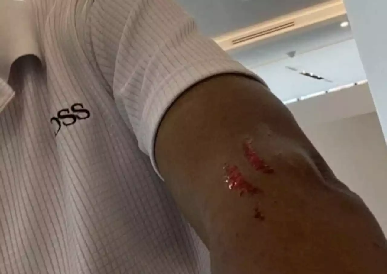 Grab suspends account of passenger who left bloody scratches on driver - Singapore News