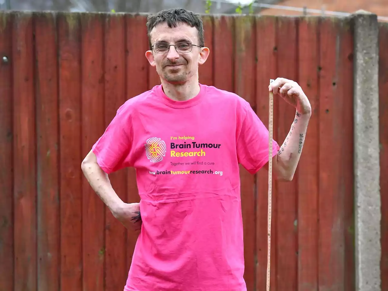 Man grows 18 inches following brain tumour surgery