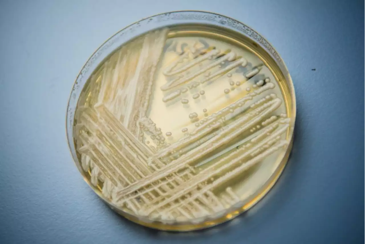 Is 'Highly Contagious' Fungus With 'Kill Rate of 60%' Spreading Through US?