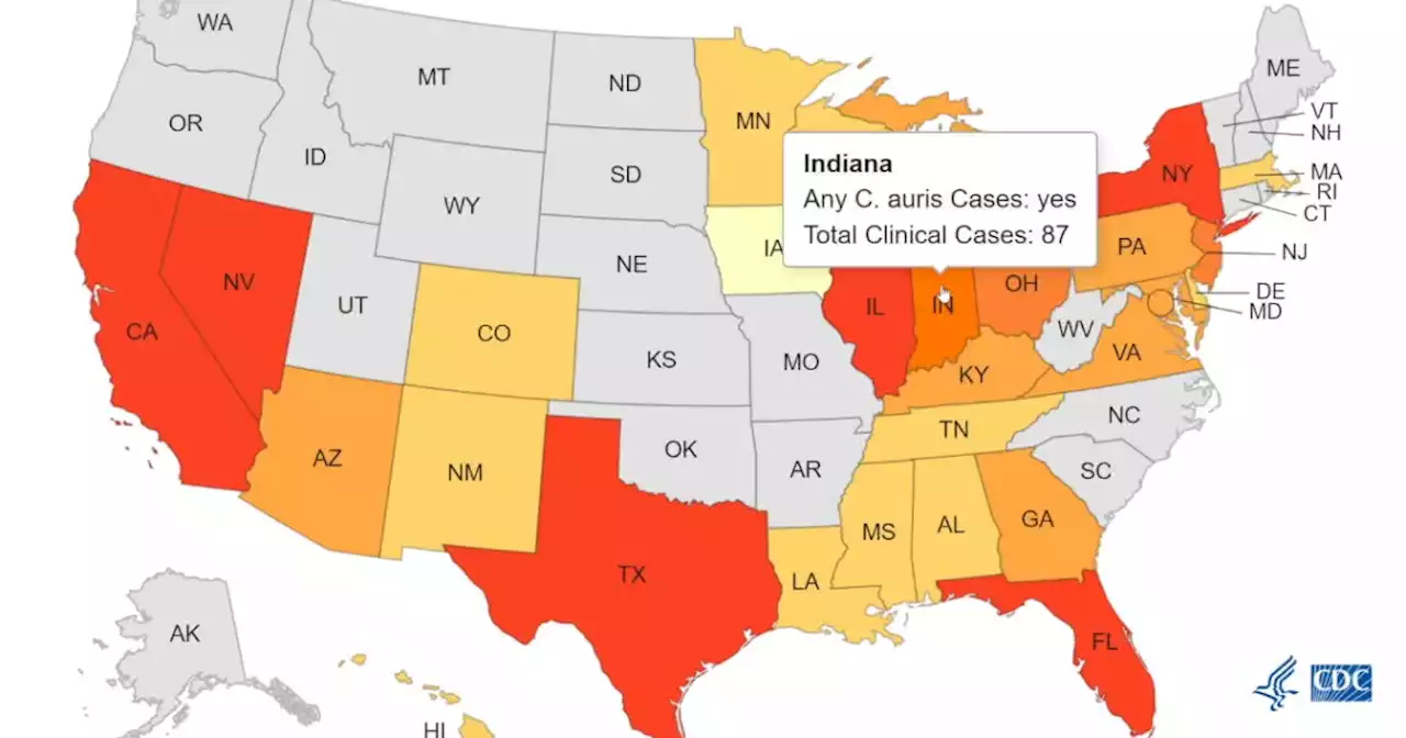 Indiana State Health Department monitoring cases of potentially deadly fungus