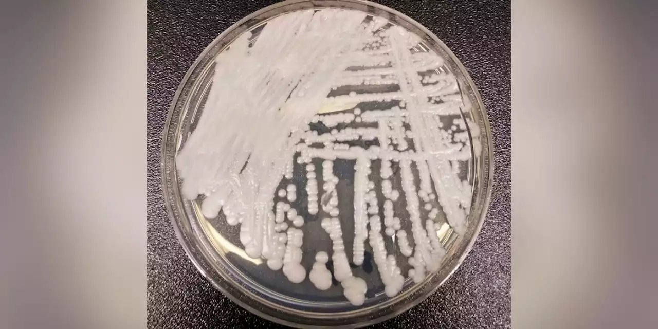 Superbug fungus cases rose dramatically during pandemic