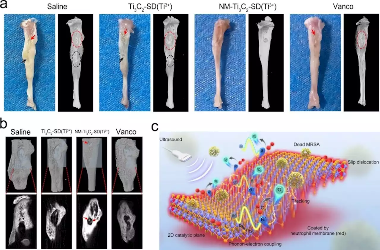 Tackling Bone Tissue Infection with 2D Ultrasound-Responsive Antibacterial Nanosheets