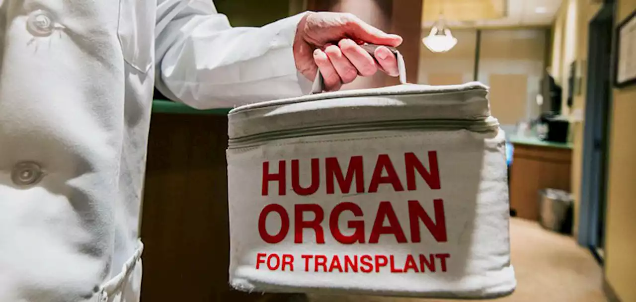 Living Kidney Donors Should Get Money for Costs of Donating