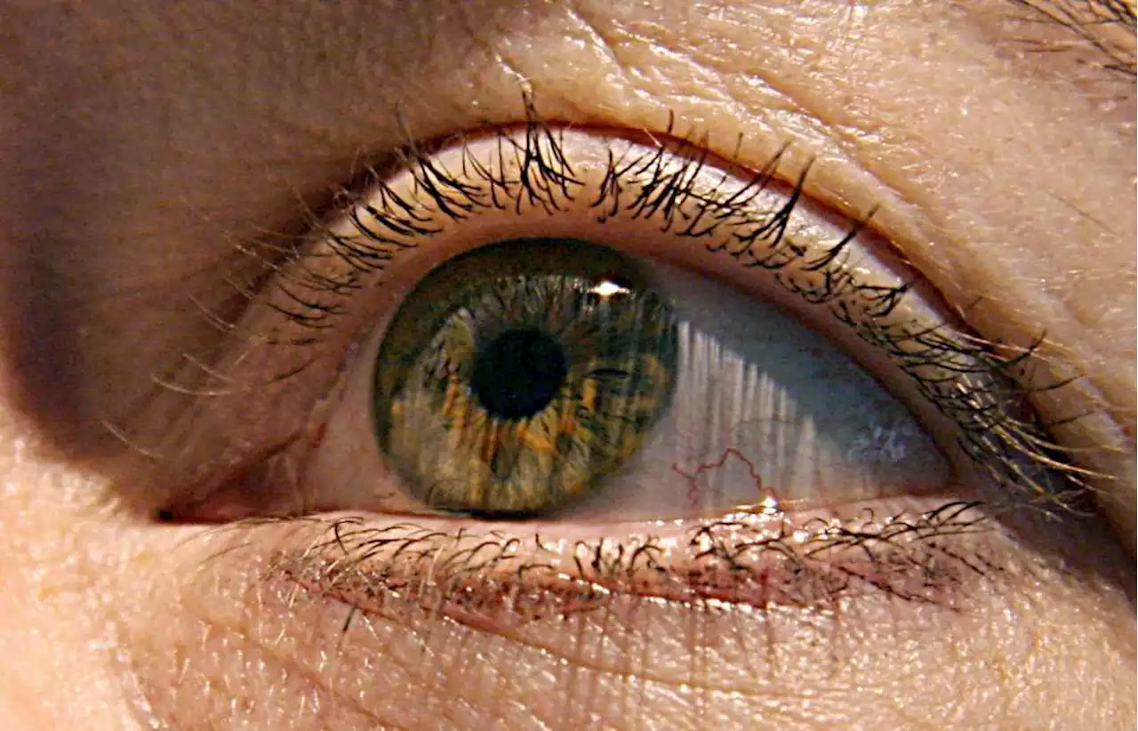 Alzheimer’s disease first signs may appear in your eyes, study finds