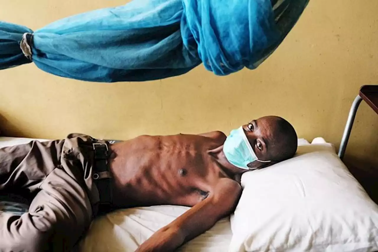 Commissioner: TB cases on the rise in Plateau -- over 10k recorded in 2022 | TheCable