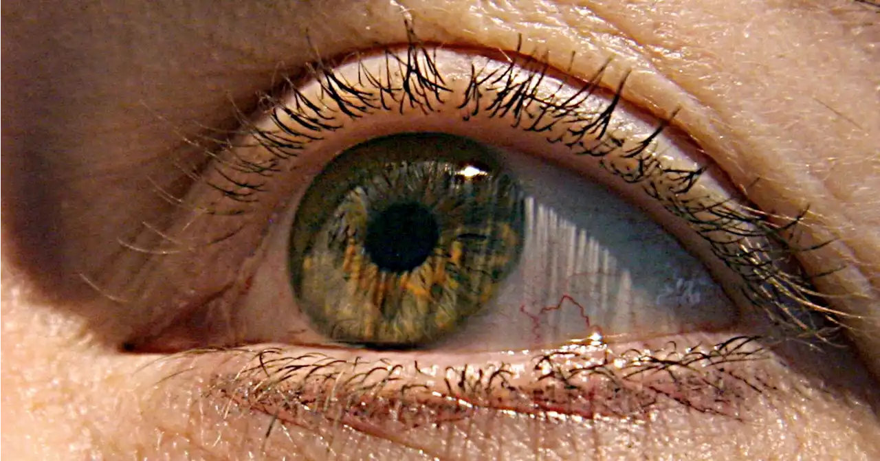 Alzheimer's first signs may appear in your eyes, study finds