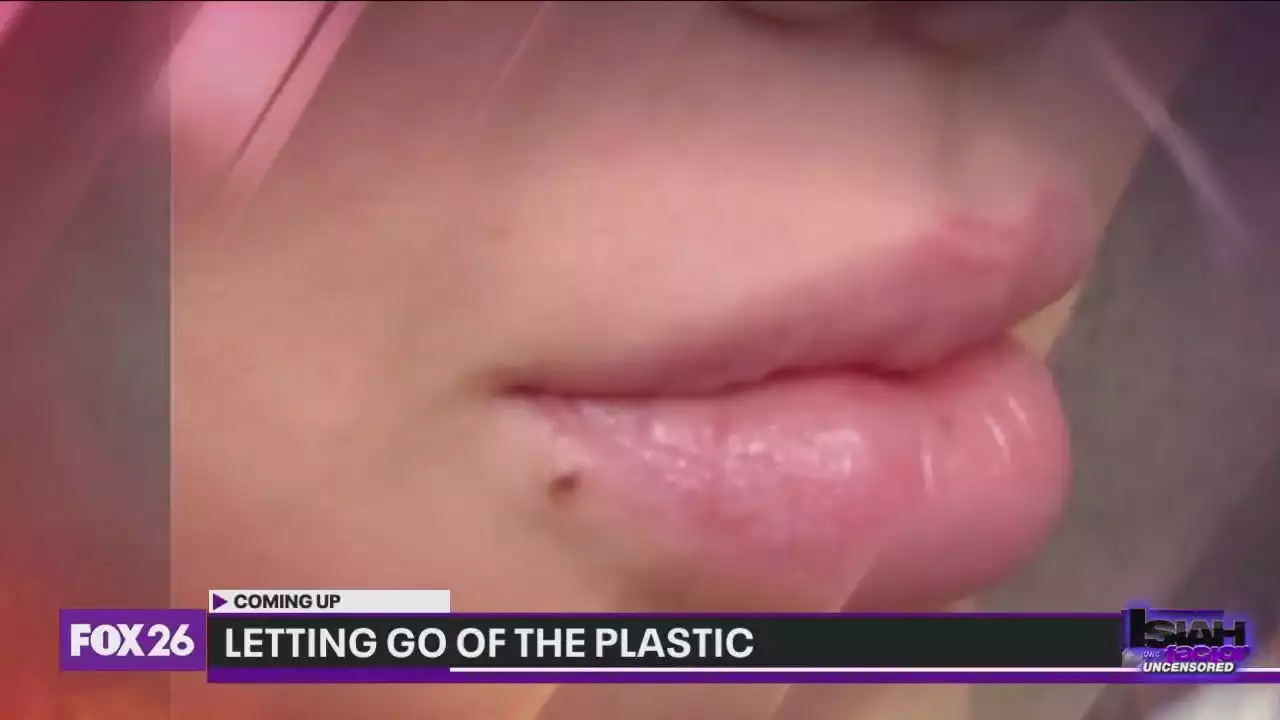 Funny Azz Friday: Plastic surgery removal trend