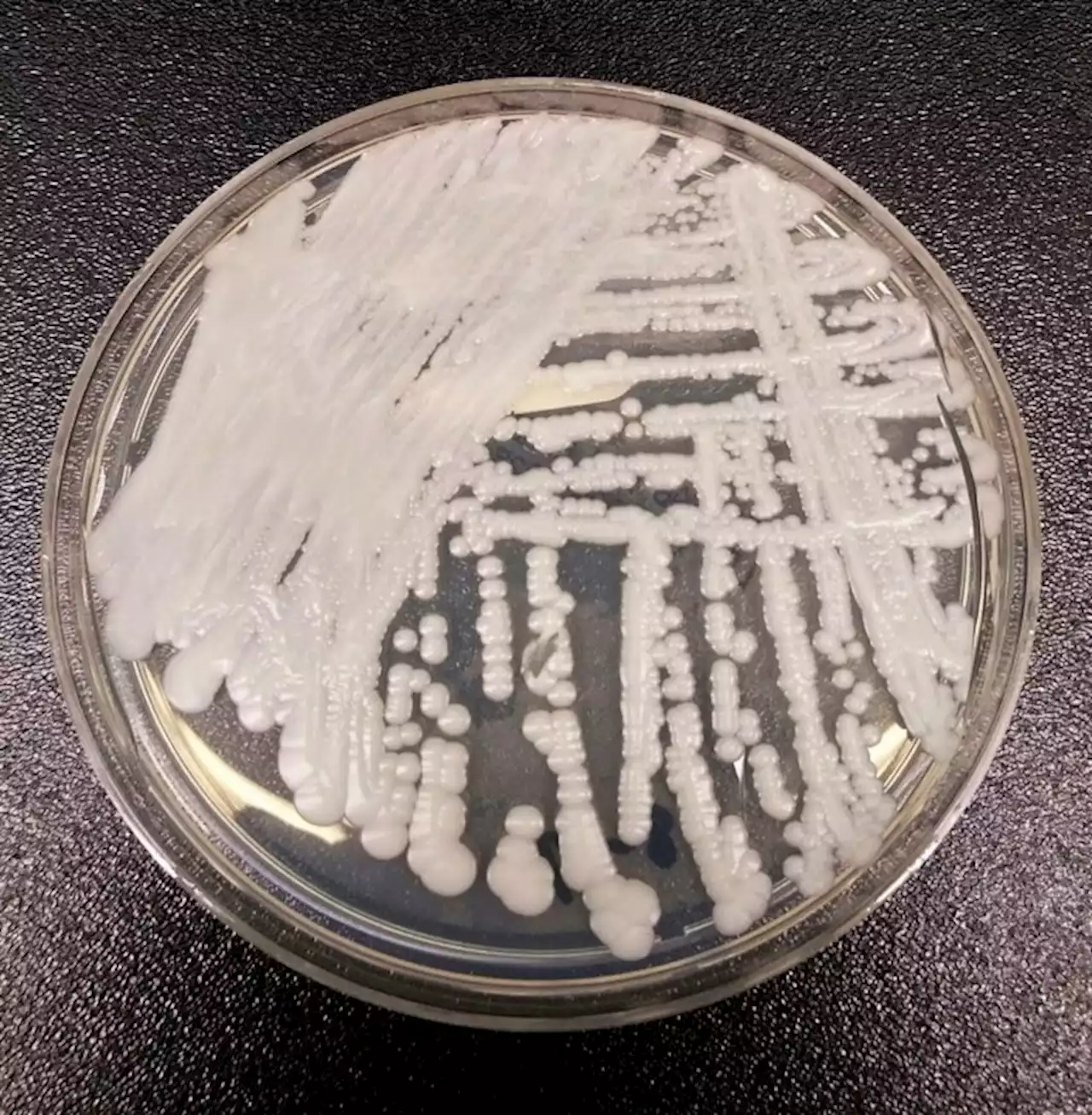 The deadly superbug CDC is warning everyone about