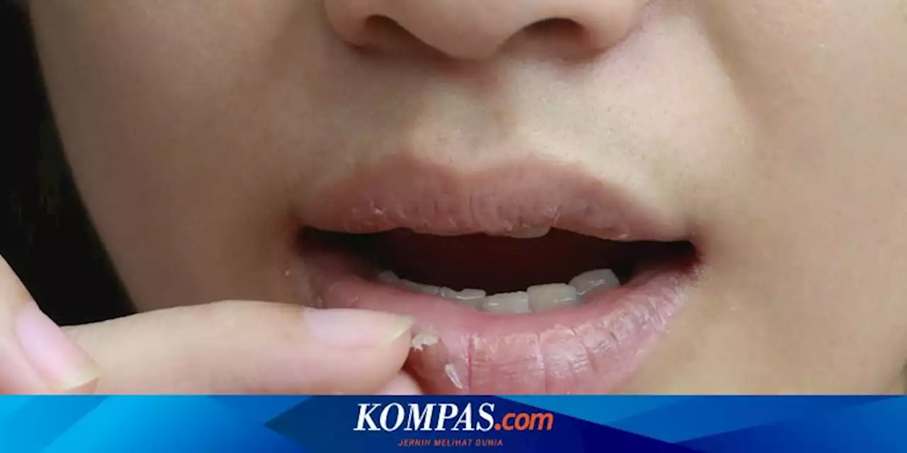 4 Cara Mengatasi Bibir Kering dan Pecah-pecah dengan Bahan Alami