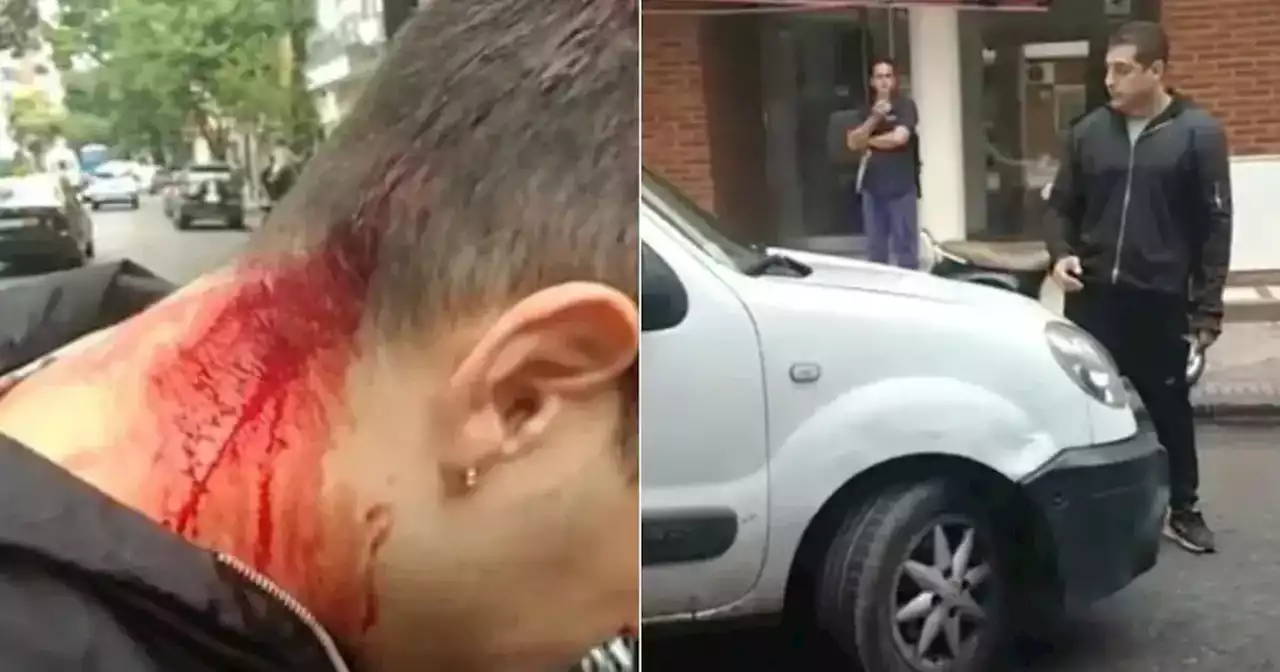 Discutió con un taxista, le pegó con un fierro en la cabeza y lo arrastró en el capó | Viral | La Voz del Interior