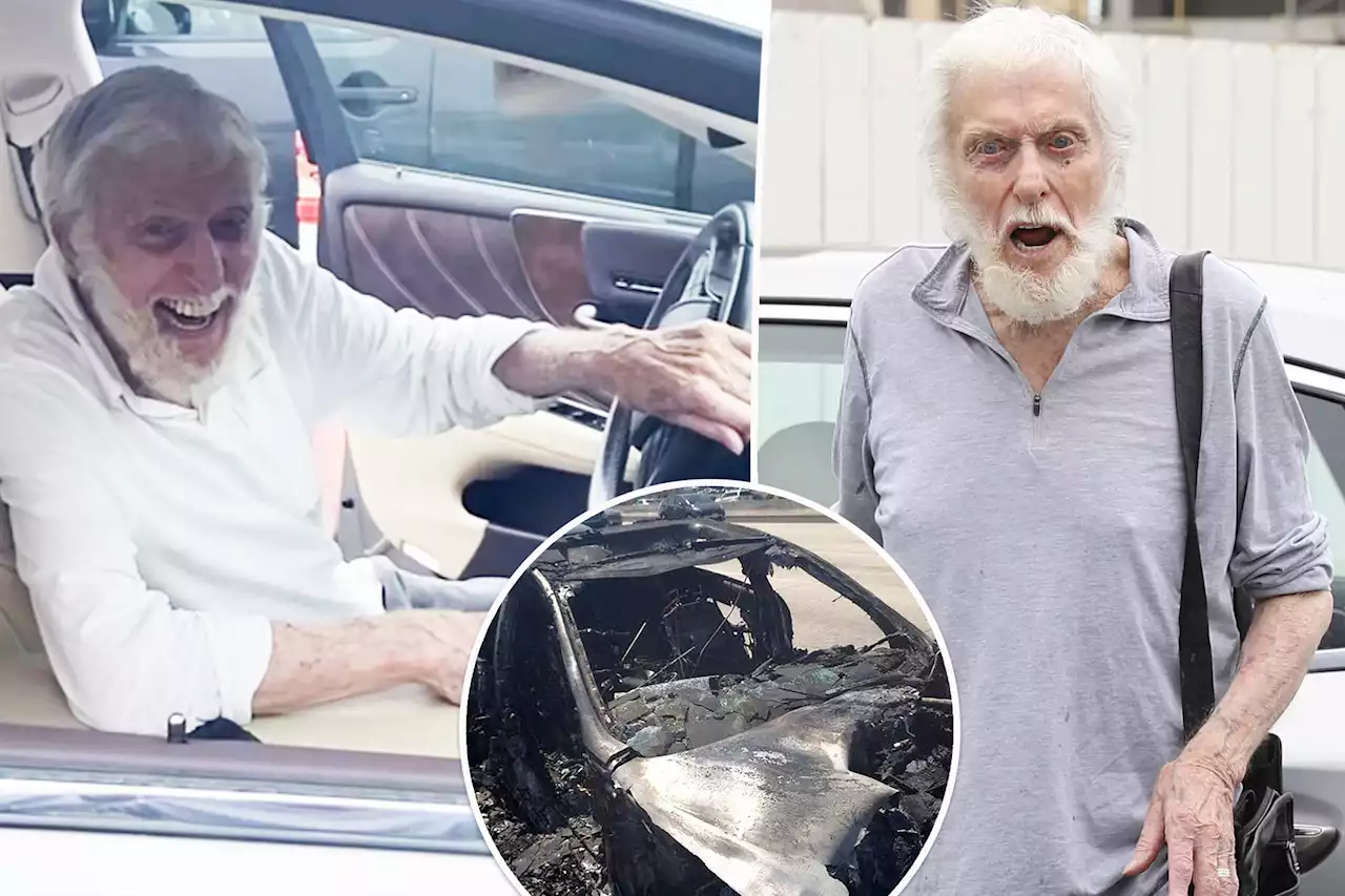 Dick Van Dyke, 97, shows off injuries in first pics since car crash