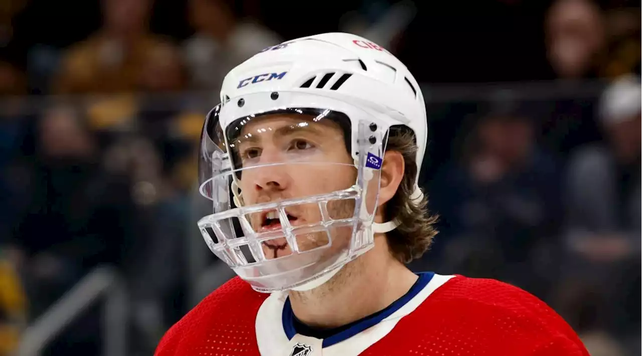 Canadiens' Mike Hoffman shows off gnarly scar after cross-check to the face