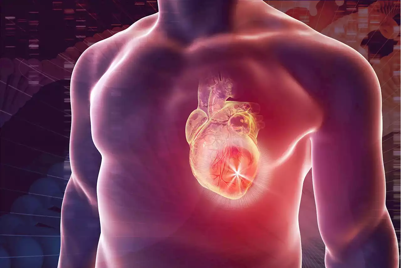 Genes Linked to Heart Disease Unexpectedly Found in Genetics Tests – Now What?