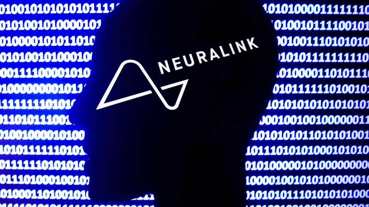 Neuralink wants to tie up with surgical partner who will implant its chips in humans