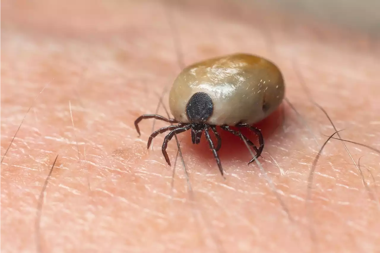 Study details bacterial agents in 418 ticks extracted from humans in France