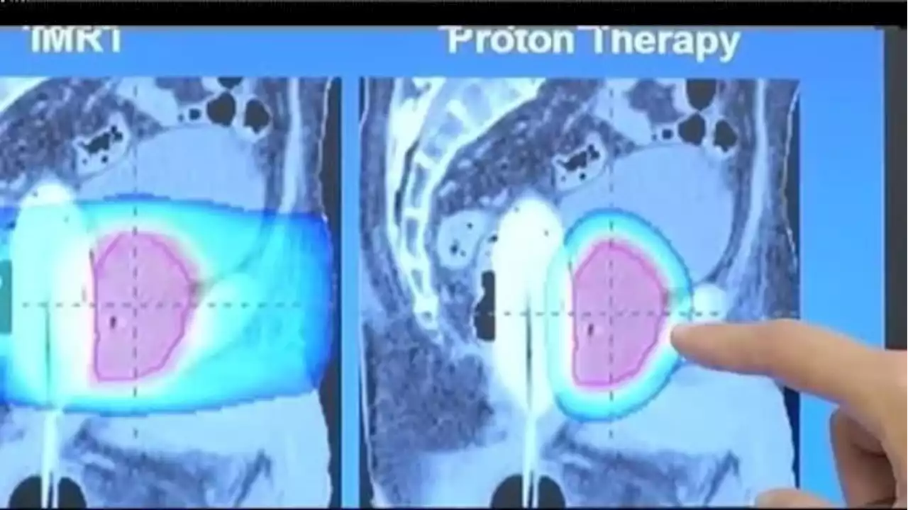 First-in-human trial: Faster proton therapy