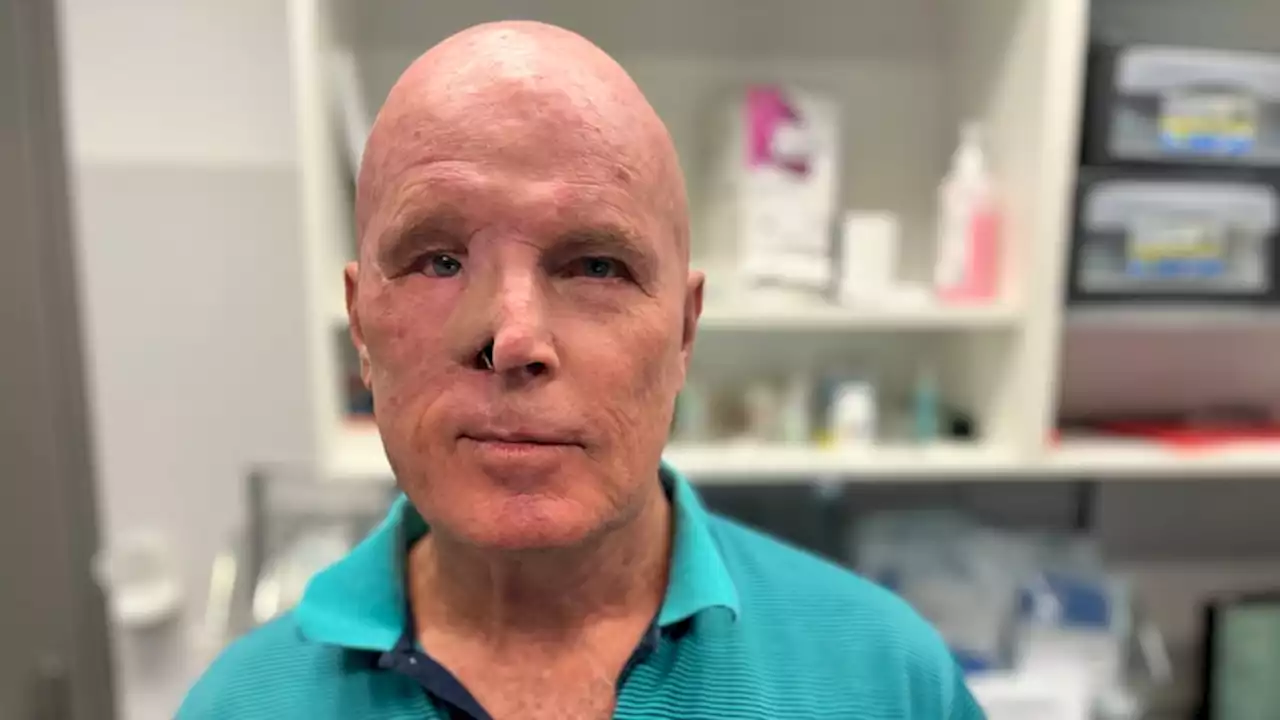 Eyelid skin cancers cause 'huge burden' on health system, surgeons urge sun safety