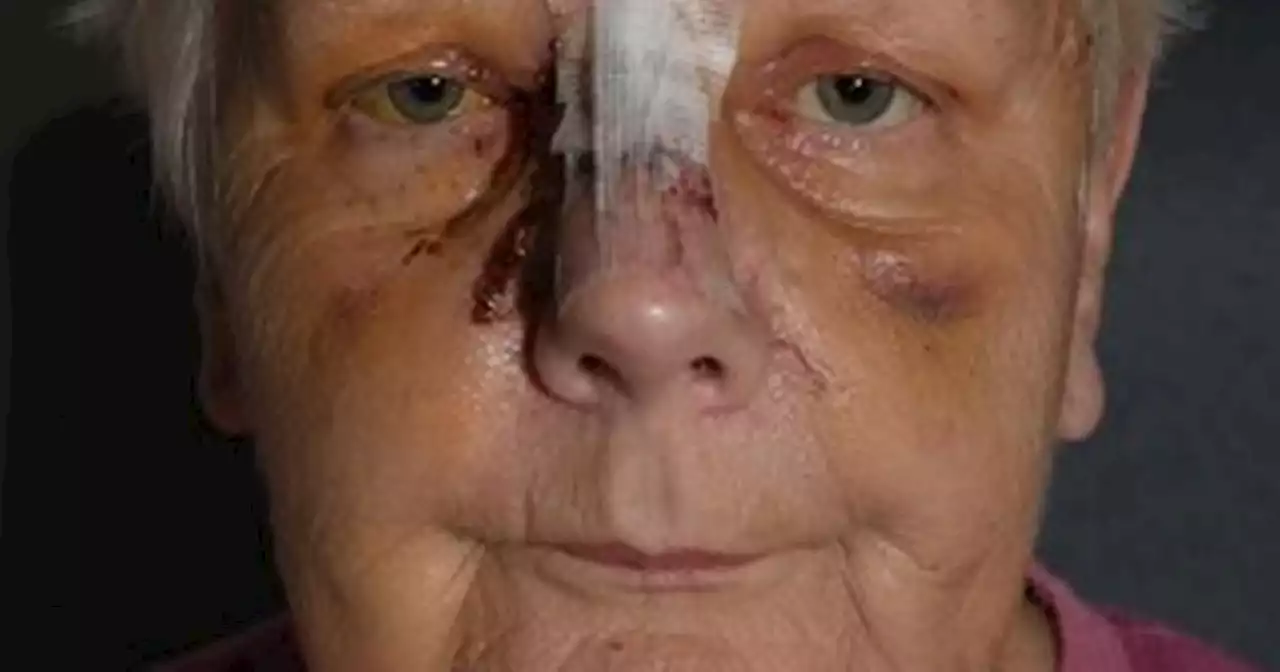 Pensioner terrified of leaving house after being attacked by out-of-control dog