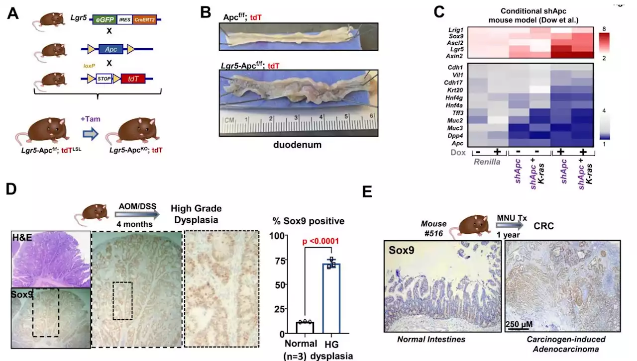 Sox9 protein enables molecular 'time travel' that can lead to colorectal cancer