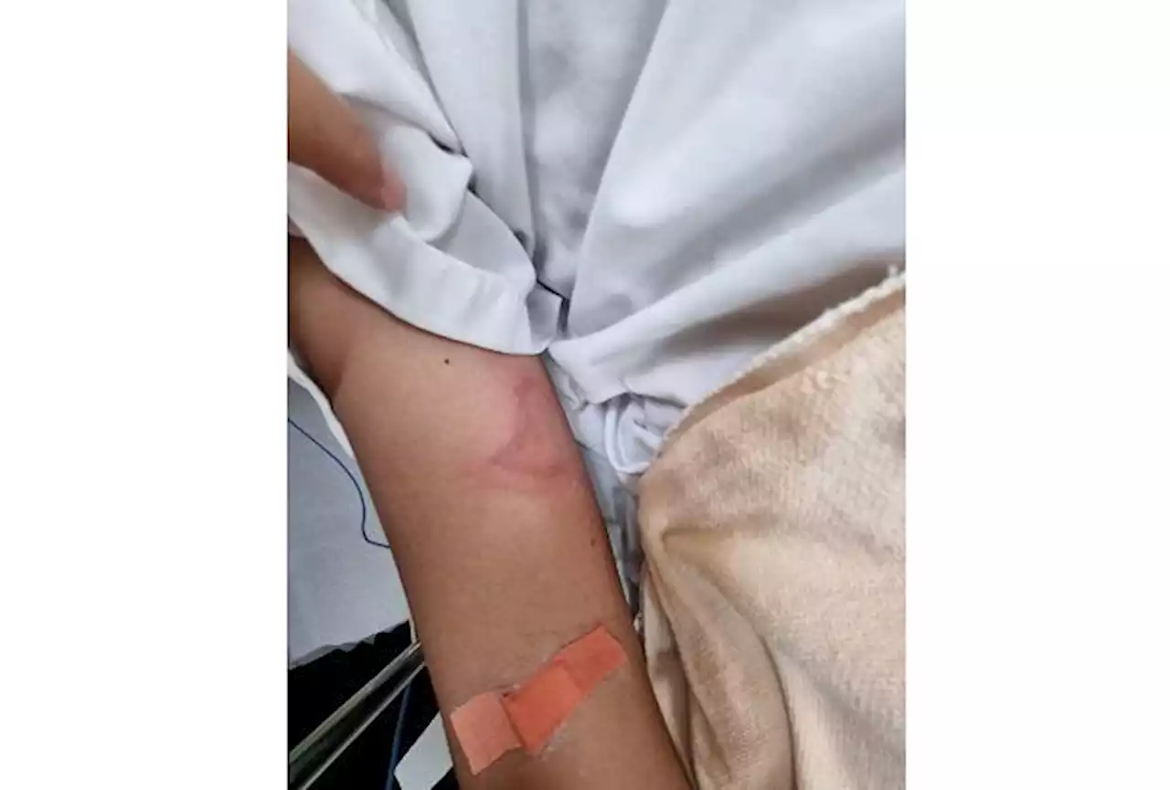 Two teens stung by jellyfish hospitalised in Penang