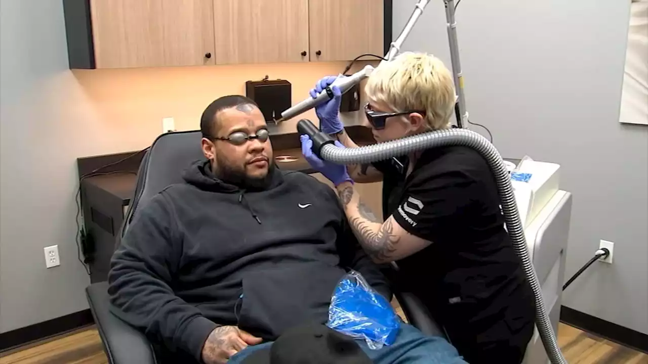 New tattoo removal company opens 1st NYC location in Flatiron District