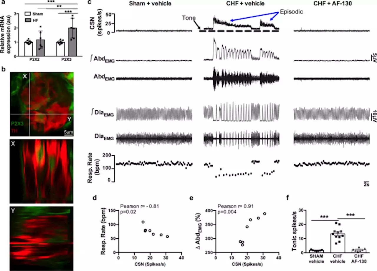 P2X3 receptor antagonism attenuates the progression of heart failure - Nature Communications