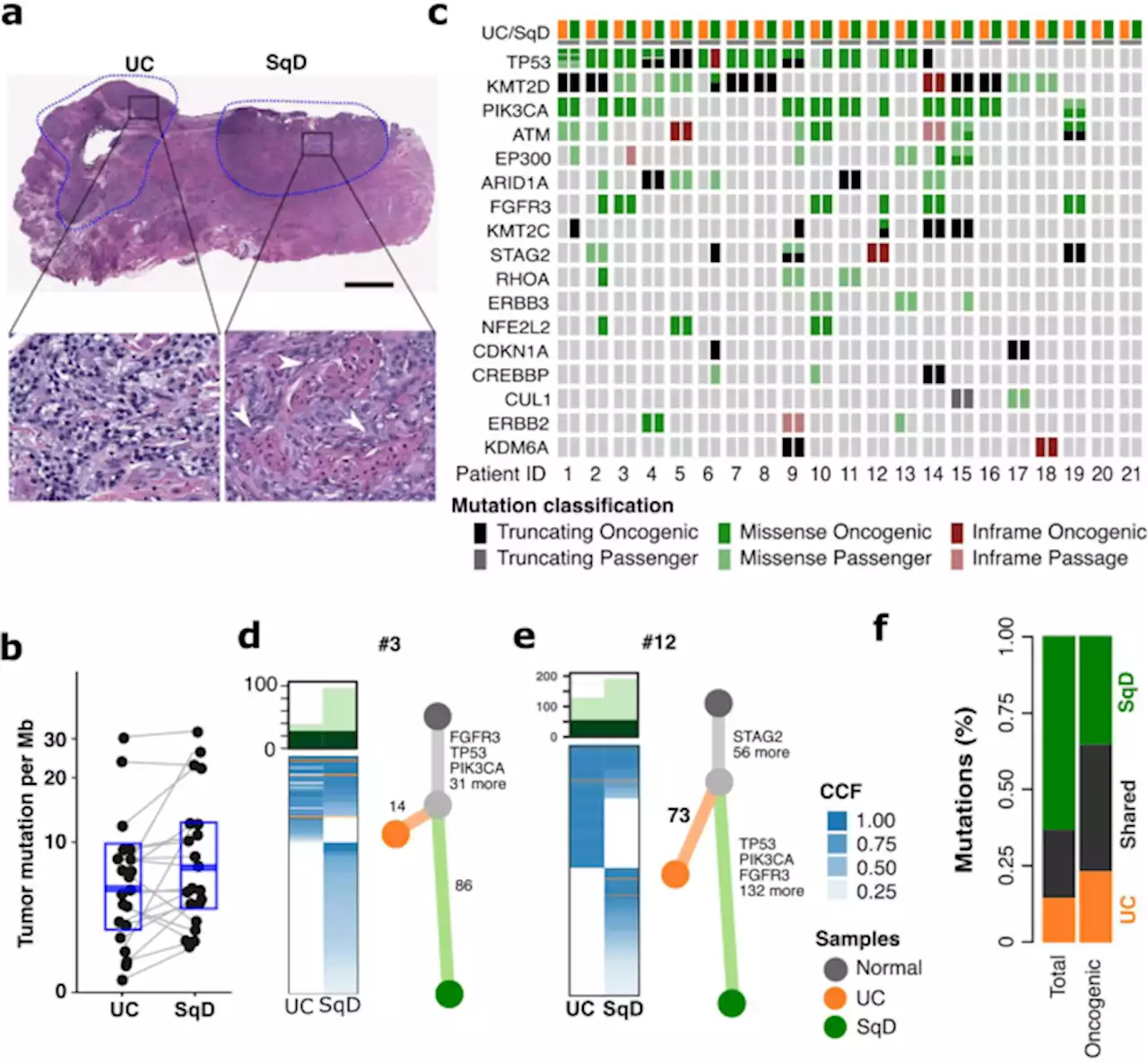 FOXA1 repression drives lineage plasticity and immune heterogeneity in bladder cancers with squamous differentiation - Nature Communications