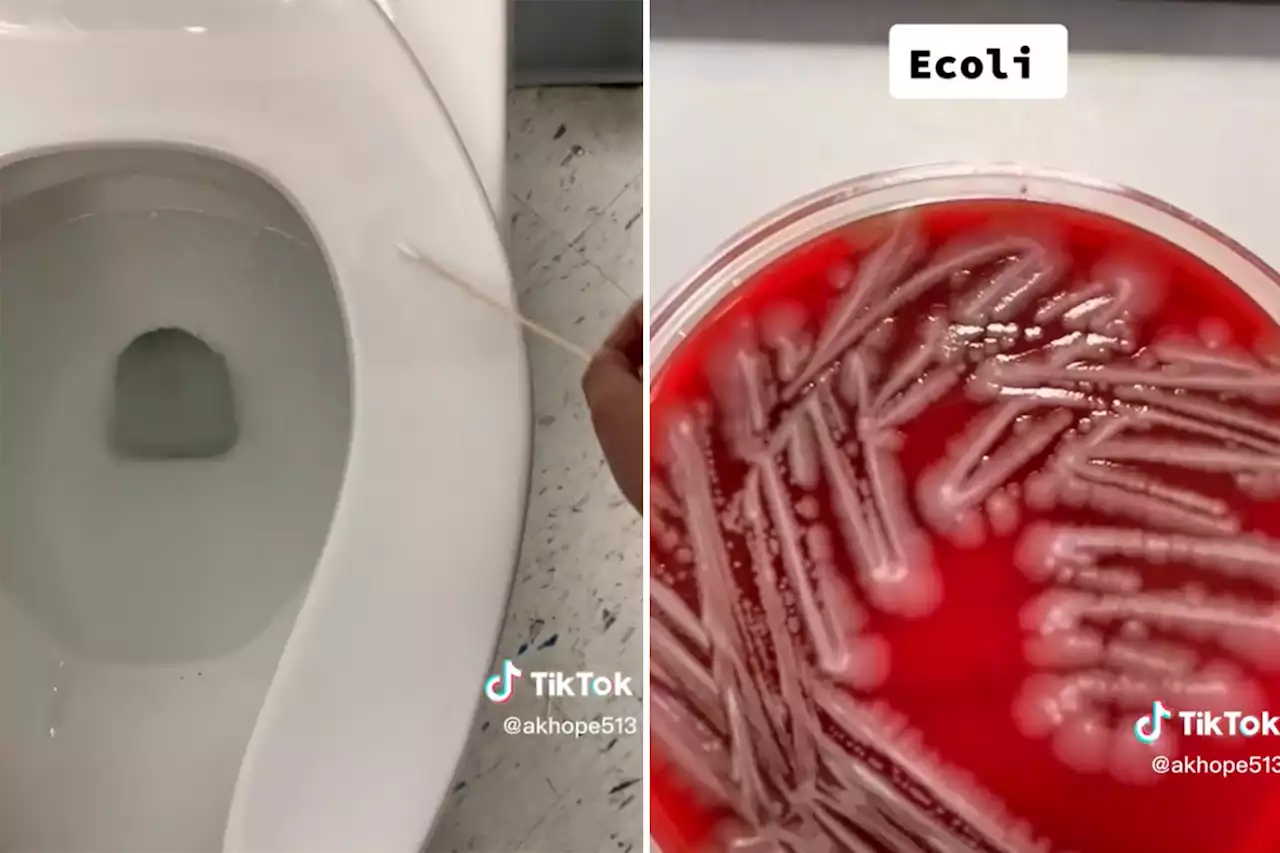 Scientist exposes hidden bacteria all over your home — including staph, E. coli