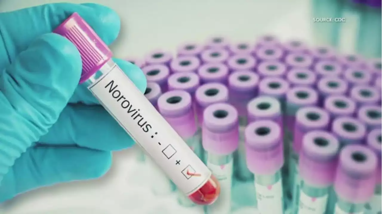 Norovirus appears to keep spreading as rate of positive tests exceeds 2022 peak