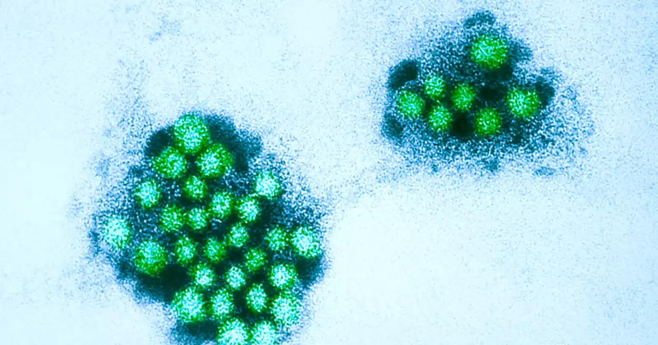 Norovirus appears to keep spreading as rate of positive tests exceeds last year's peak