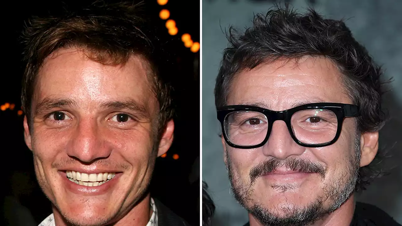 Pedro Pascal -- Good Genes Or Good Docs?!