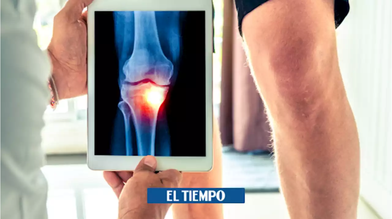 Artroscopia de rodilla: qué es, para qué sirve y qué riesgos tiene