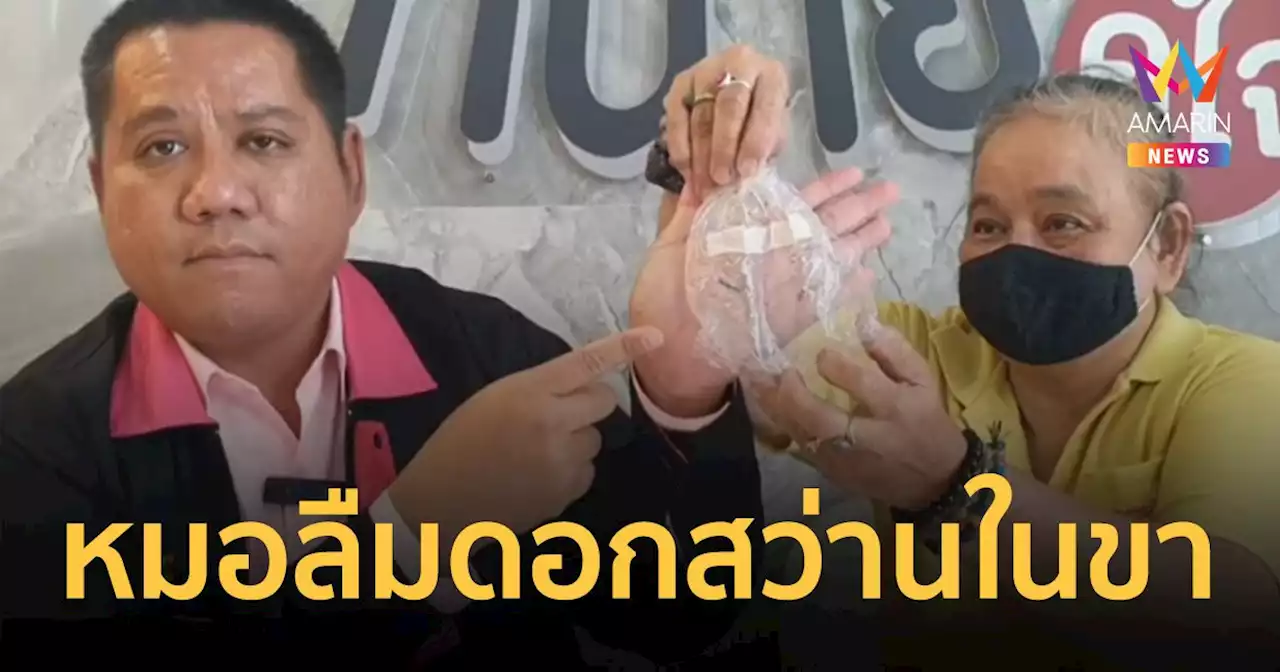 หมอลืมดอกสว่านทิ้งไว้ในขาป้าวัย 57 รพ. ทำนิ่ง ไม่เยียวยา